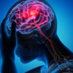 Can sTMS Magnet Therapy Help Relieve Migraine Pain?